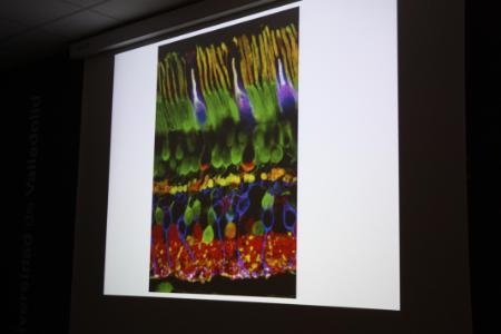 Impressive confocal microscopy images of retinal sections by Prof Cuenca